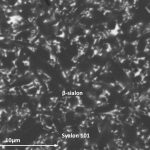 Syalon 101 - beta Micrograph